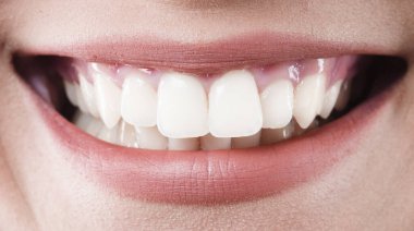 Gülümseyen bir insanın dişlerini gösteren yakın plan görüntüsü..