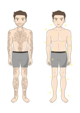 Men's Beauty depilation (whole bodyA) clipart