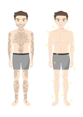 Erkek güzellik epilasyon (tüm bodyb)