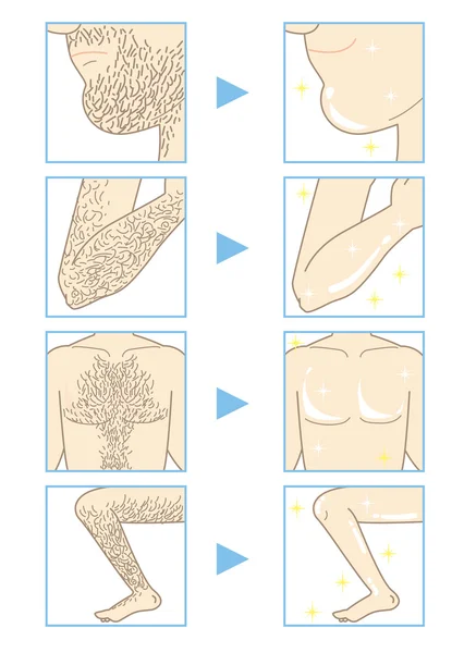 Депиляция мужской красоты (части тела А) ) — стоковый вектор