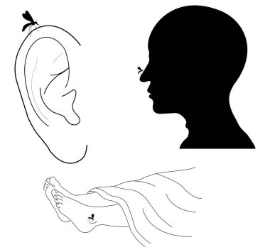 Sivrisinek insan burnuna ve ayağına konar ve kan içmek için deriyi ısırır. Sahne, insan vücudunda yaygın böcek besleme davranışlarını gösteriyor ve hastalık yayılma ve sivrisinek ısırığı riskini vurguluyor..