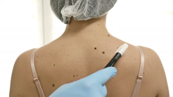 Dermatologe untersucht Muttermale weiblicher Patientin. — Stockvideo
