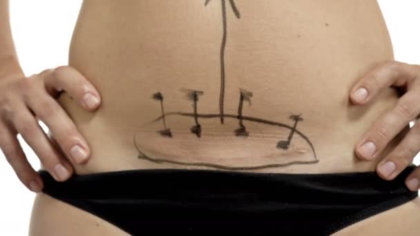 Der plastische Chirurg bereitet einen Patienten auf eine Fettabsaugung vor. Arzt zeichnet mit Marker Linien auf den weiblichen Körper. — Stockvideo