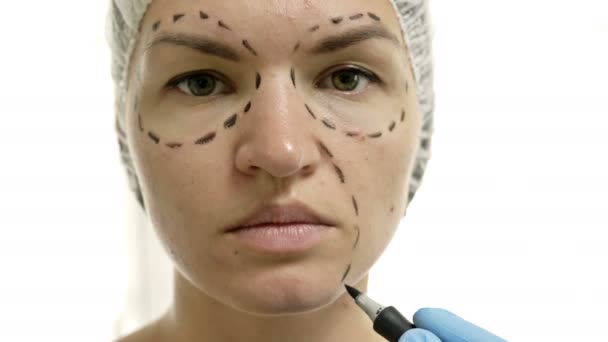 Mooie jonge vrouw met perforatielijnen op haar gezicht voor plastische chirurgie. Schoonheidsspecialiste raakt vrouw gezicht. — Stockvideo