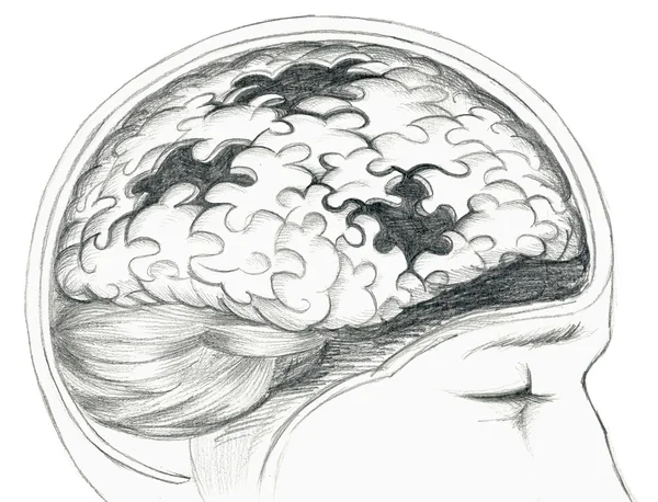 Cinza cerebral humano doente — Fotografia de Stock