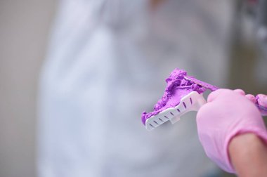 Diş ameliyatı. Protez işe yarıyor. Diş hekimi, diş ve çene protezinin izi için boşluk yaratıyor. Eldivenli doktor protez moru için ham bir karışım tutuyor.