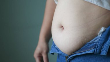 Weight gain, obesity risk, poor diet habits and health problem related to modern sedentary lifestyle. Close up overweight belly and unbuttoned jeans, body fat and unhealthy lifestyle concept.