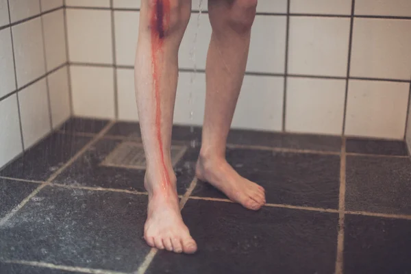 Garçon avec blessure au genou prend douche dans la salle de bain — Photo