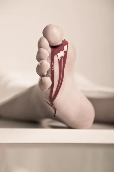Piciorul sângerat al unei victime a unui accident într-un morgă — Fotografie, imagine de stoc