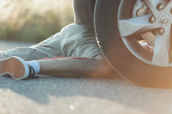 Pernas de macho atropelado por carro — Fotografia de Stock