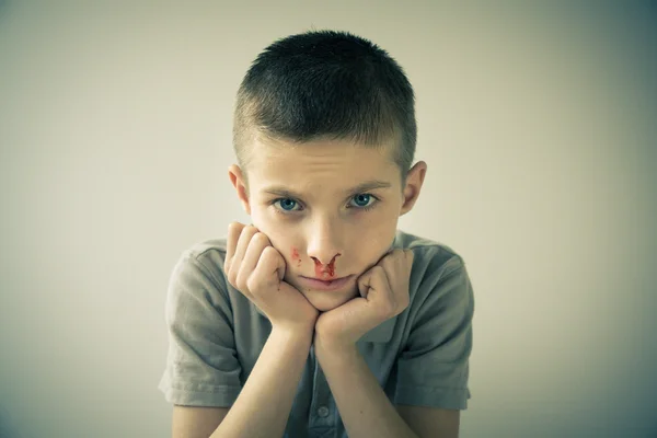 Boy with Bloody Nose Resting Head in Hands — Stock Photo, Image