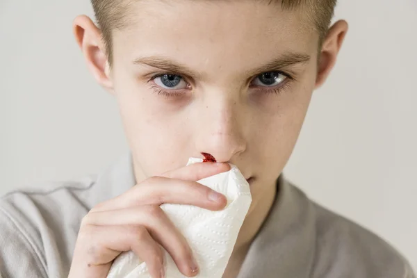 Niño con camisa gris sostiene tejido a la nariz sangrante —  Fotos de Stock