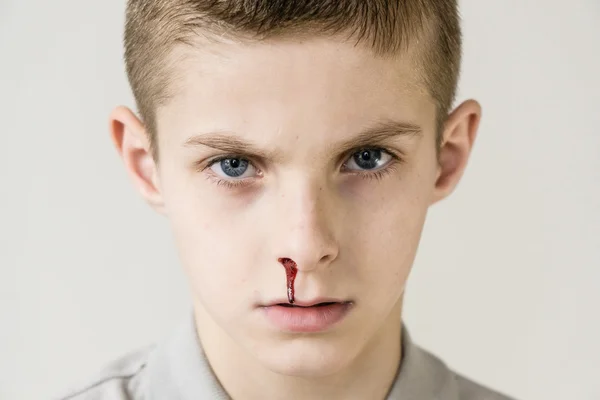 O sangue goteja do nariz da criança masculina no cinza — Fotografia de Stock