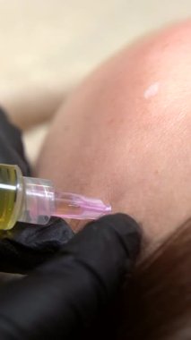 Kozmetik uzmanı kadının alnına birden fazla enjeksiyon yapıyor. Yakın çekim. Güzellik kliniğinde mezoterapi ve yüz gerdirme. Güzellik uzmanlarının elleri ve kızların yüzü.
