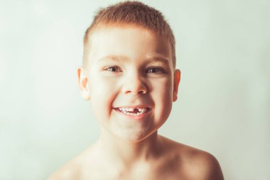 Pediatrik dişçilik konsepti. Dişi olmayan tatlı duygusal çocuk..