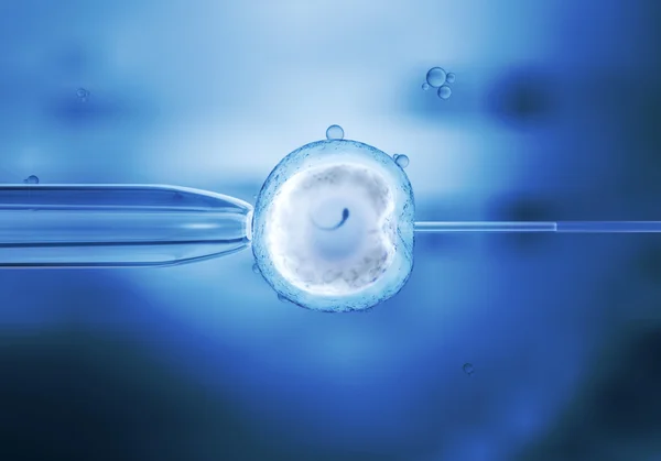 체 외 수정에의 계란 셀-Ivf — 스톡 사진