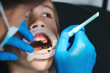 Hasta çocuk diş sağlığı kliniğini ziyaret ediyor. Dişçi oğlanın dişlerini inceliyor. Klinikte diş tedavisi gören bir çocuk. Diş hekimi ortodontisi. Dişçi koltuğundaki korkmuş çocuk..