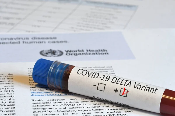 Florence Juni 2021 Bloedbuis Voor Detectie Van Virus Covid Delta — Stockfoto