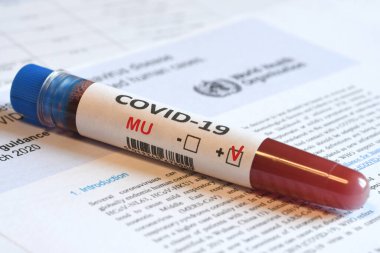 Covid-19 Mu Varyantı virüsünün tespiti için kan tüpü kağıtlarda olumlu sonuç verdi.