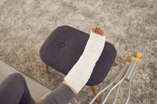 Nő törött lábbal gipsz öntött megy rehabilitáció és pihenés otthon — Stock Fotó