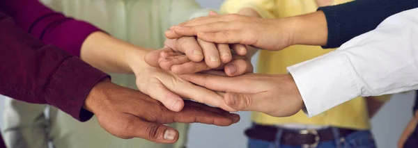Close up de um grupo de pessoas internacionais dobrando os braços, apoiando uns aos outros. — Fotografia de Stock