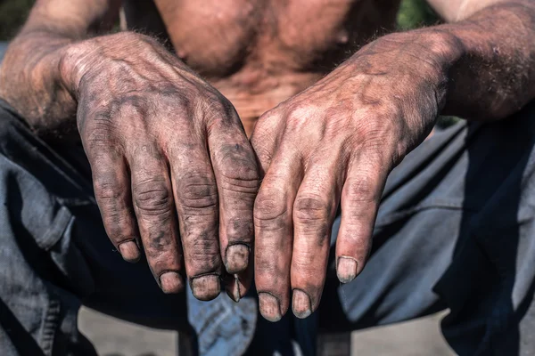 Werknemer vuile handen. — Stockfoto