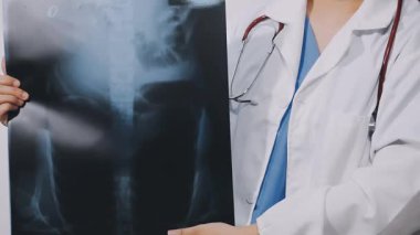 doctor in the white coat holding a xray.