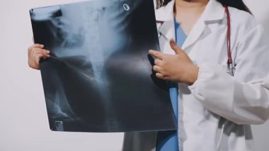 Doktor X-ray filmi tutuyor.