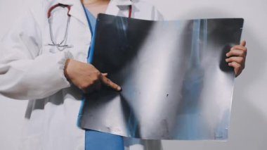 Genç doktor X-ray 'i elinde tutuyor..