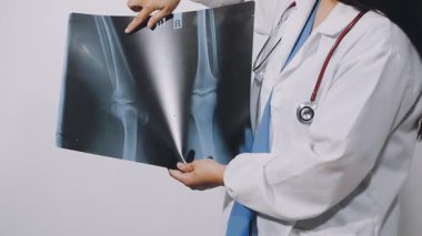 Doktor X-ray filmi tutuyor.