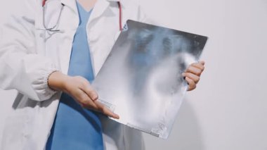 Doktor X-ray filmi tutuyor.