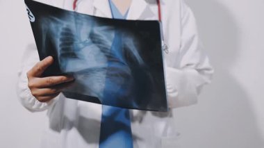 male doctor holding a ray - ray