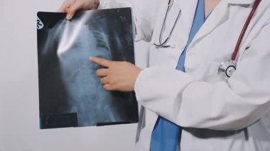 doctor holding x - ray of lungs