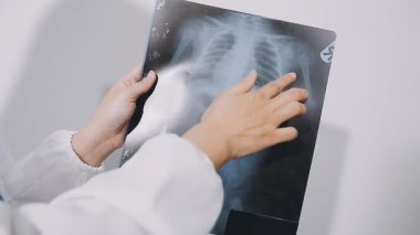 doctor holding x - ray in hospital office.