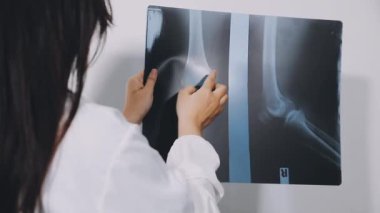 Doktor X-ray 'i inceliyor.