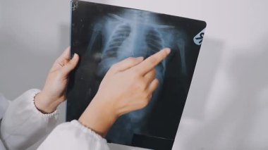 doctor holding x - ray of lungs