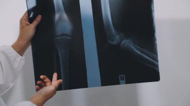 doctor in the white shirt holds a x - ray.