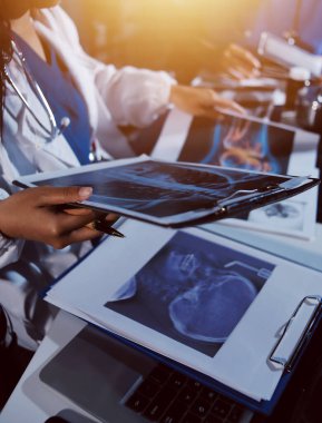 Doktorlar tedavi seçeneklerini tartışmak ve iş arkadaşlarıyla deneyimleri paylaşmak için hastanede toplanıyorlar.