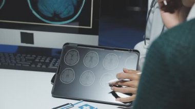 doctor holding x - ray of human brain