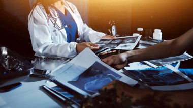 Doktorlar tedavi seçeneklerini tartışmak ve iş arkadaşlarıyla deneyimleri paylaşmak için hastanede toplanıyorlar.