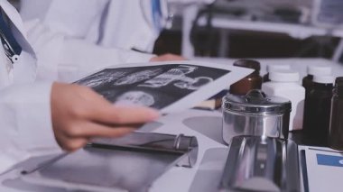 Tıbbi ekip Afro-Amerikan Toplantısı göğüs röntgeni filmi Radyologları Uzmanlık alanı teşhis, tedavi, hastalıklar, radyoloji, prosedür sınavları, testler