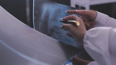 Tıbbi ekip Afro-Amerikan Toplantısı göğüs röntgeni filmi Radyologları Uzmanlık alanı teşhis, tedavi, hastalıklar, radyoloji, prosedür sınavları, testler