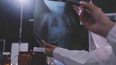 Tıbbi ekip Afro-Amerikan Toplantısı göğüs röntgeni filmi Radyologları Uzmanlık alanı teşhis, tedavi, hastalıklar, radyoloji, prosedür sınavları, testler