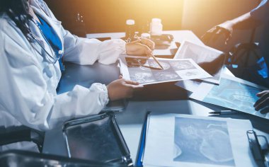 Doktorlar tedavi seçeneklerini tartışmak ve iş arkadaşlarıyla deneyimleri paylaşmak için hastanede toplanıyorlar.