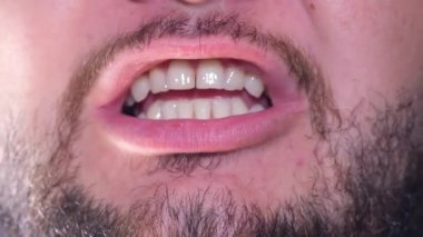 Sakallı bir adam ağzı açık konuşur.. 