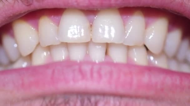 Bouche d'un homme aux dents droites blanches. — Video