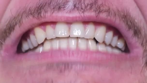 Het gezicht van een jonge gek close-up die schreeuwt met zijn mond wijd open — Stockvideo