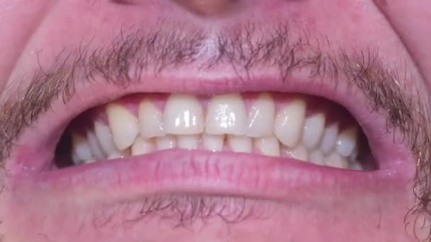 Hombre con bigote apretando los dientes — Vídeos de Stock