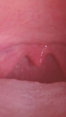 Tıbbi veya eğitimsel kullanım için insan boğazının anatomik özelliklerini ve iç yapısını gösteren detaylı yakın çekim videosu.