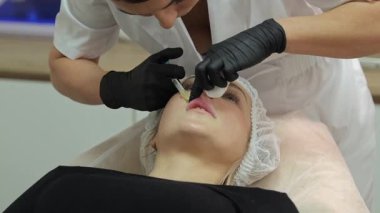 Uzman kozmetolojist, hastanın üst dudağına arttırmak için hiyalüronik asit enjekte ediyor.